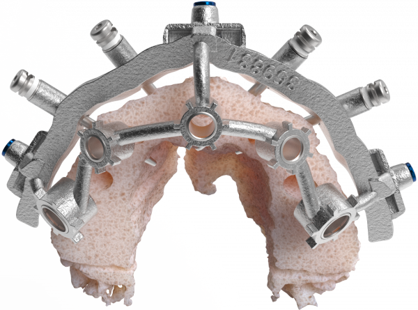 CHROME-Components-Stacked-Osteotomy-Guide