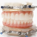 CHROME-Prosthesis-Square