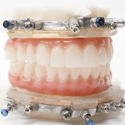 CHROME-Prosthesis-Square