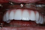 IMG_3957-1-1024x683