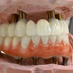 TLZ-CHROME-Natural-Upper-PMMA-Lower
