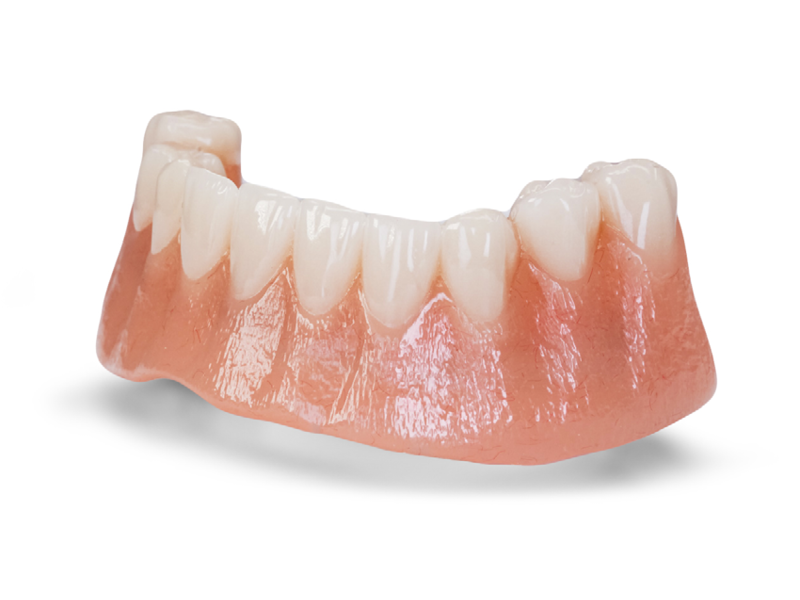Product Tiles_Full-Arch_Bar Overdenture