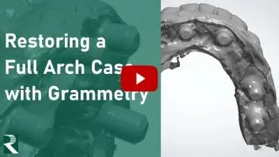 Restoring-a-Full-Arch-Case-with-Grammetry-400x225