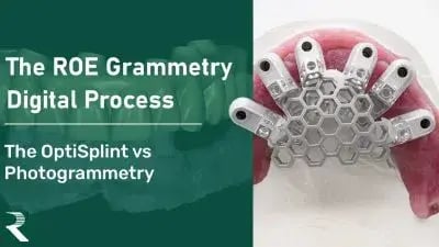 SThe-ROE-Grammetry-Digital-Process-OptiSplint-vs-Photogrammetry-400x225