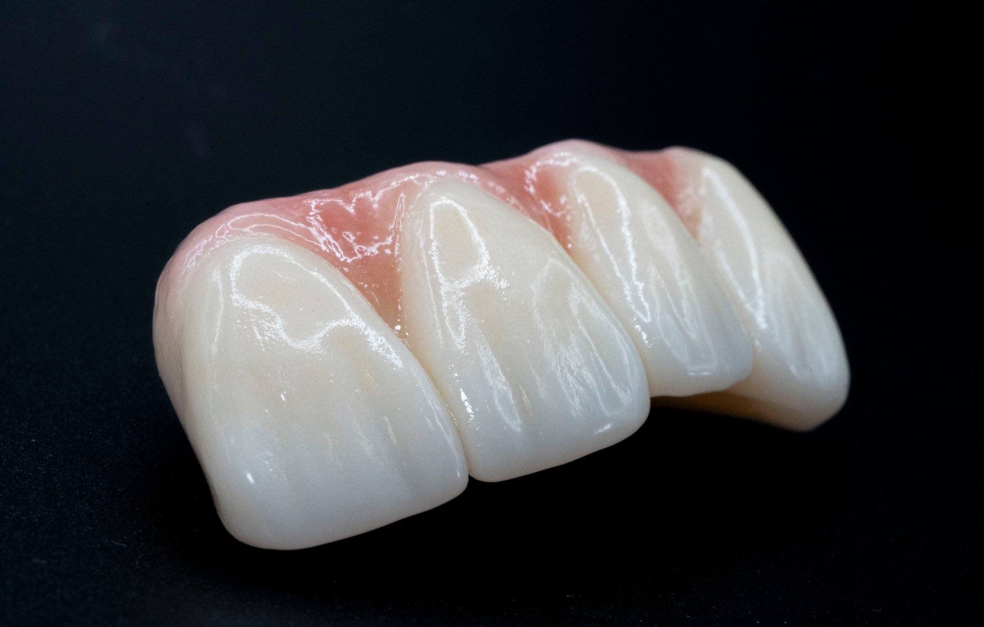 Bespoke Crowns