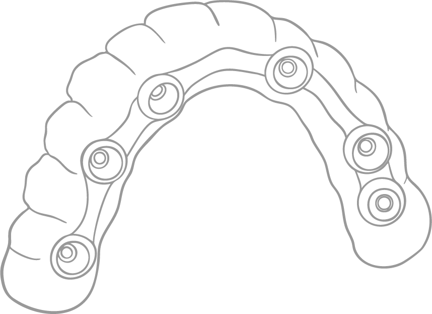 TLZ-IB Lineart Metal TLZ-IB Lineart Metal