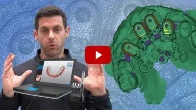 The-OPTIMAL-Way-To-Capture-Full-Arch-Grammetry-Records-400x225