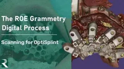The-ROE-Grammetry-Digital-Process-Scanning-for-OptiSplint-400x225 (1)