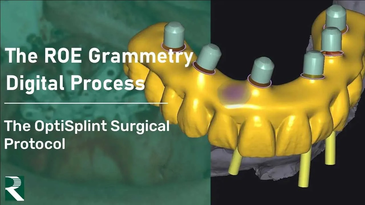 The-ROE-Grammetry-Digital-Process-The-OptiSplint-Surgical-Protocol