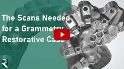 The-Scans-Needed-for-a-Grammetry-Restorative-Case-400x225