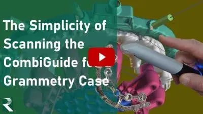The-Simplicity-of-Scanning-the-CombiGuide-for-a-Grammetry-Case-400x225