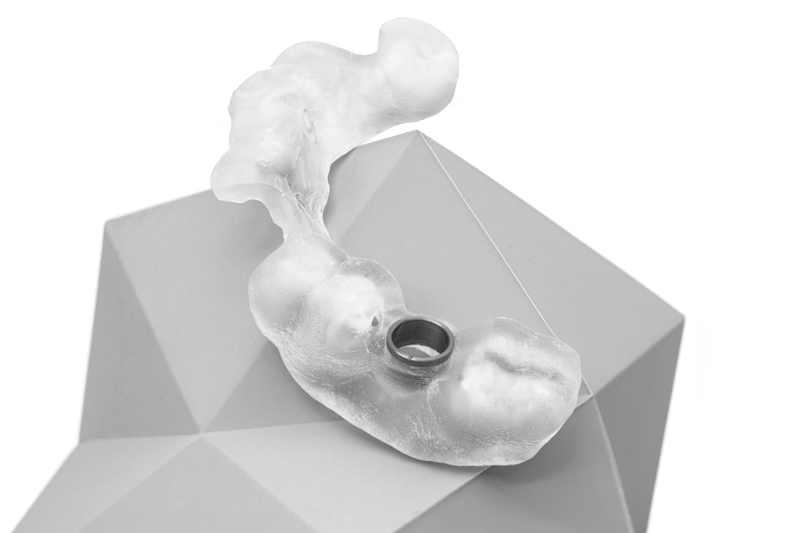 Tooth-Supported-Surgical-Guide-Single
