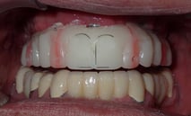 48