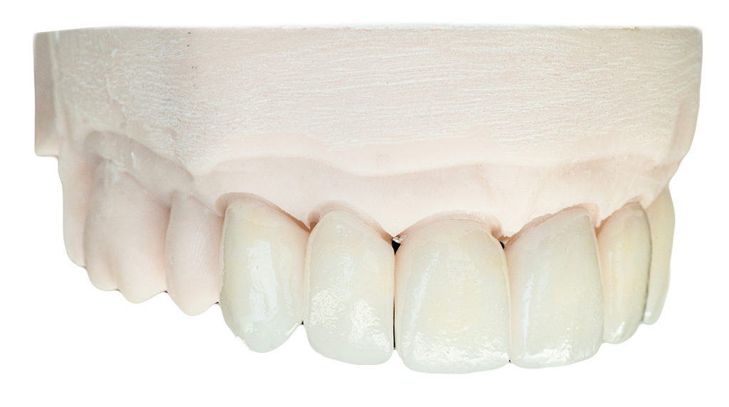 e.max Layered@0.5x