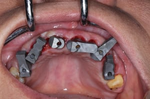 gram-arch-2