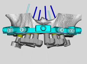 gram-arch-4