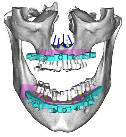 gram-arch-5
