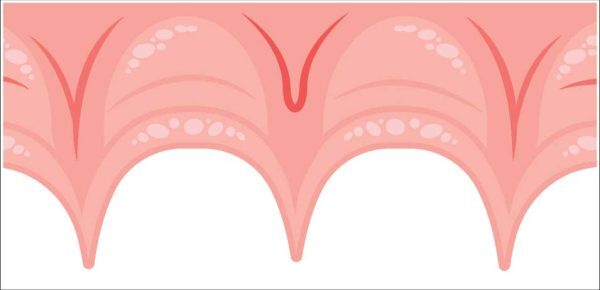 gt-pronounced-600x290