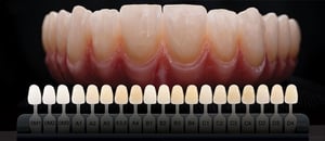 imgi_25_short-shades