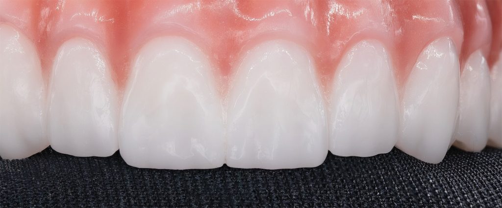 light-tooth-texture-1024x426