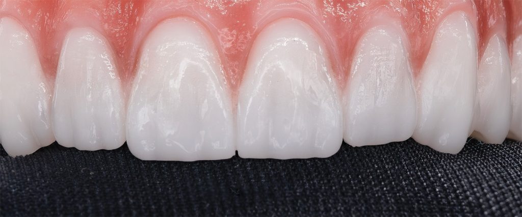 medium-tooth-texture-1024x426