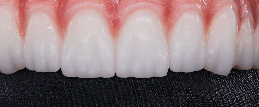 pronounced-tooth-texture-1024x426