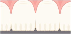 tt-medium-600x290