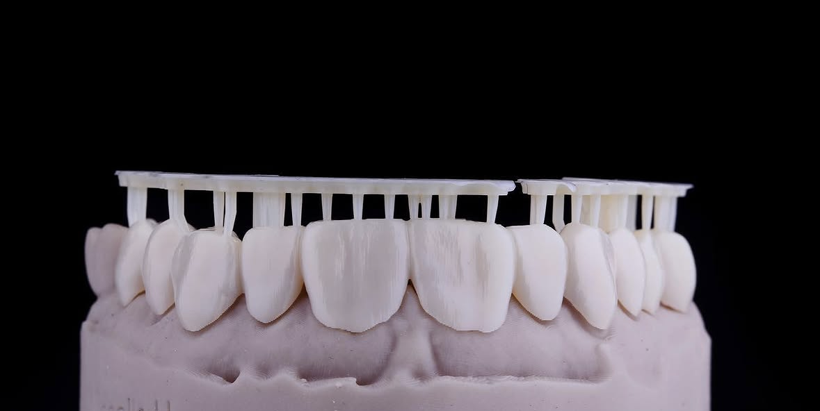 3d-printed-try-in