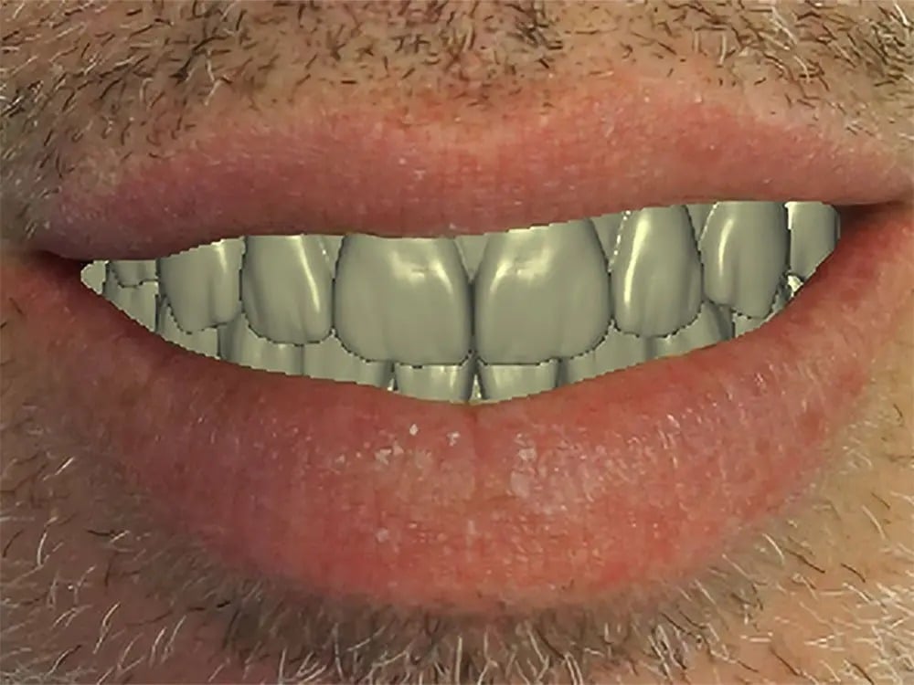4 4