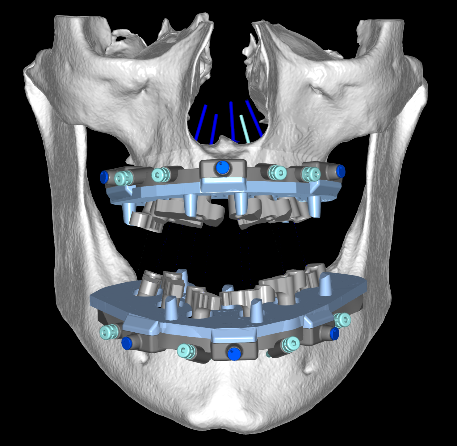 GuidedSMILE Digital