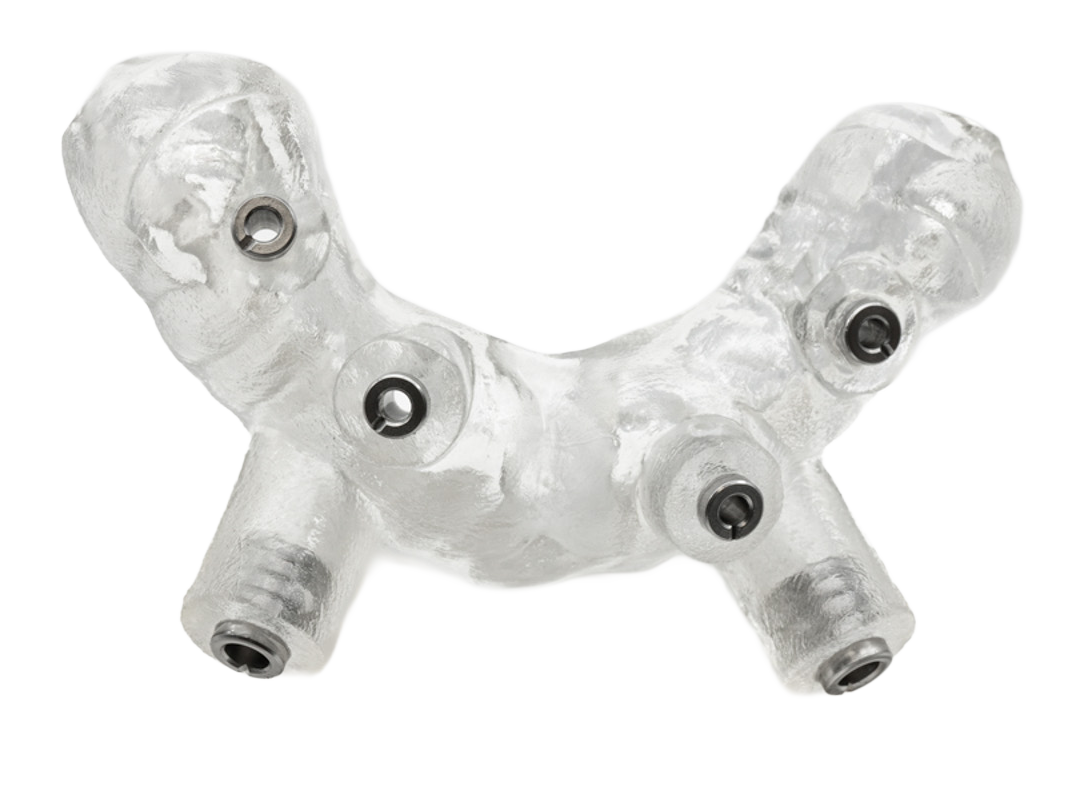 Bone-Supported-Guide-Pilot-Anchor-Holes