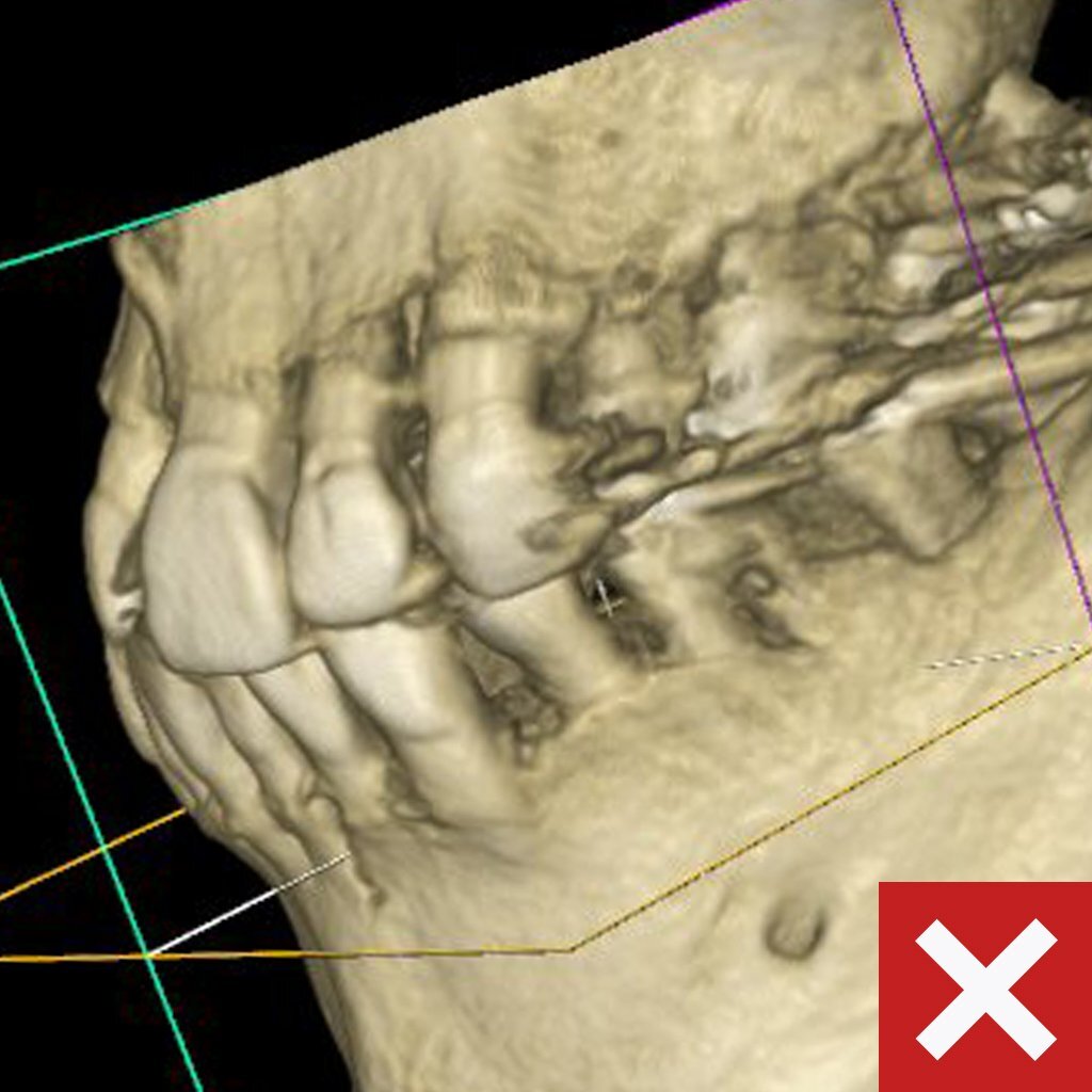 Labeled-CHROME-CBCT-Bad Labeled-CHROME-CBCT-Bad