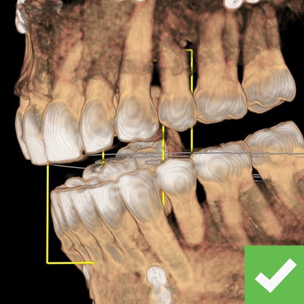 Labeled-CHROME-CBCT-Good Labeled-CHROME-CBCT-Good