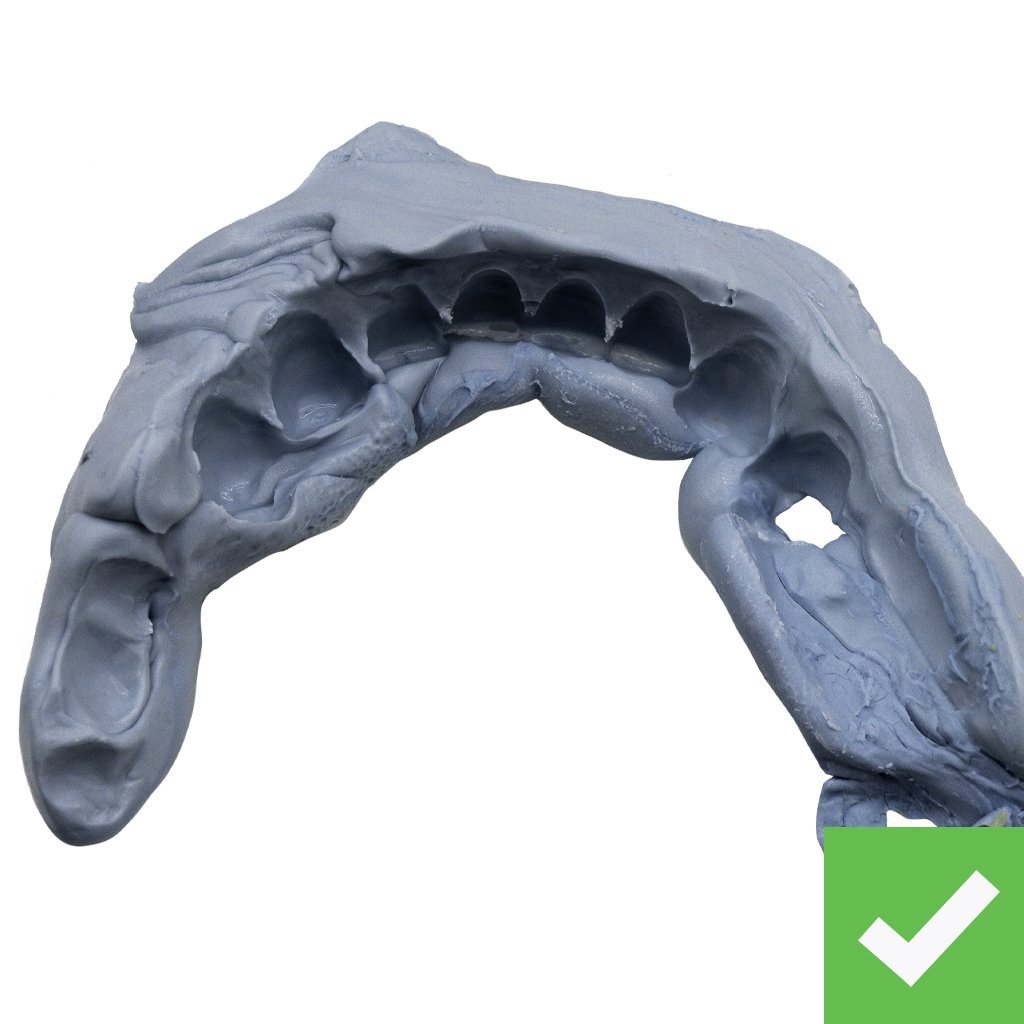 Labeled-CHROME-Patient-Impressions-Good-Bite Labeled-CHROME-Patient-Impressions-Good-Bite