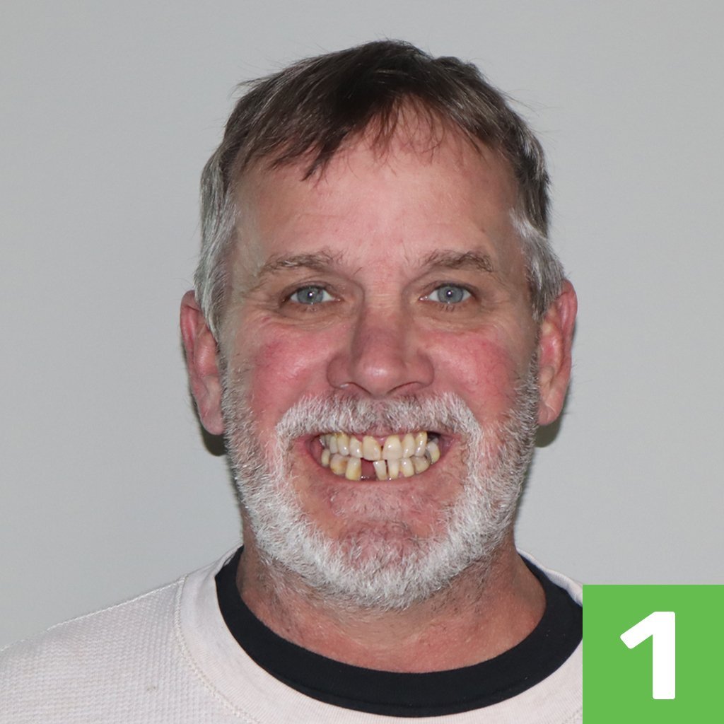 Labeled-CHROME-Patient-Photos-1 Labeled-CHROME-Patient-Photos-1