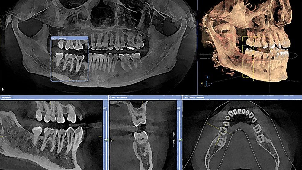 cbct2 cbct2