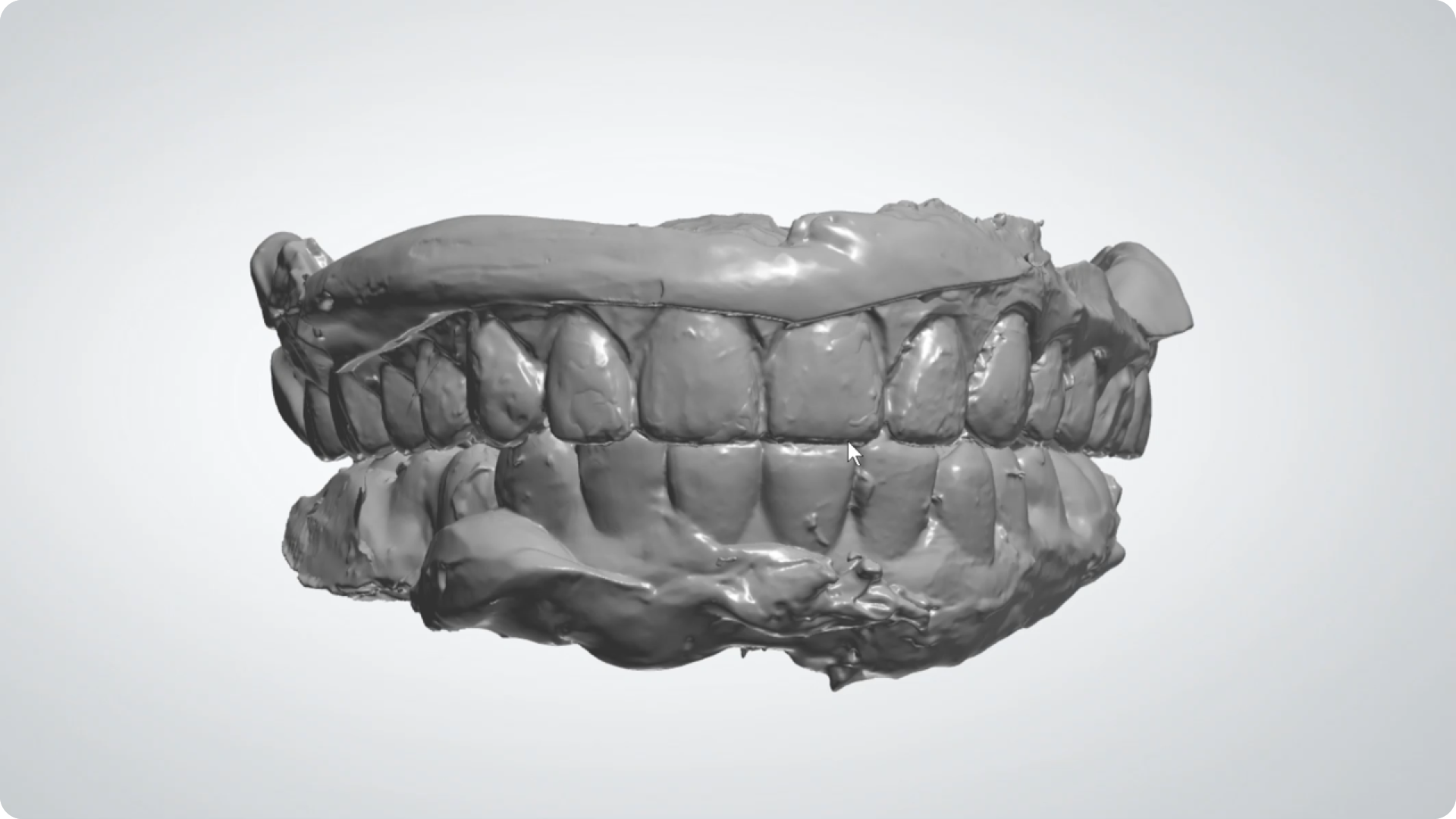 Denture Records_01