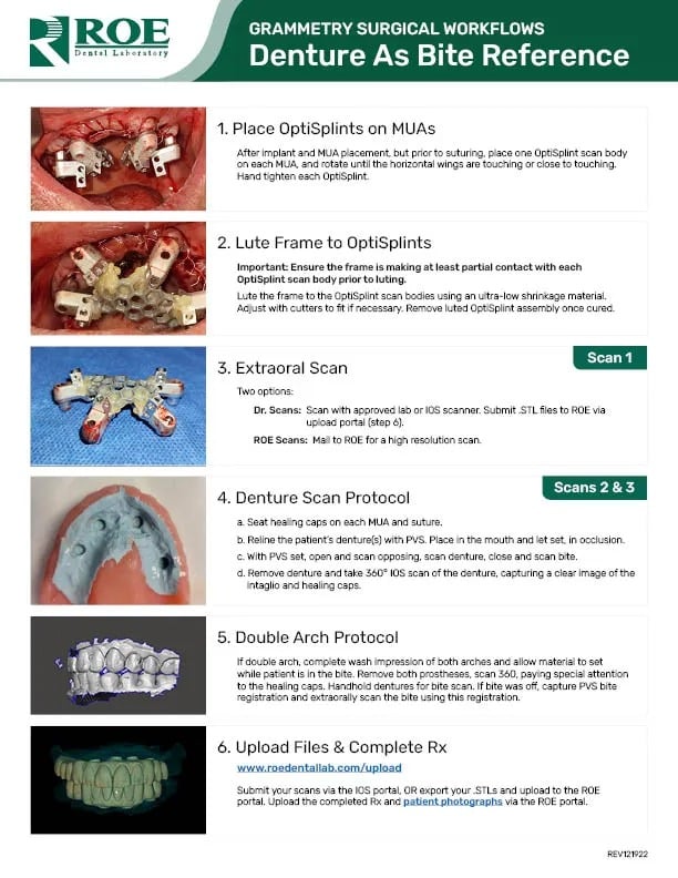 Grammetry-Workflow-Denture