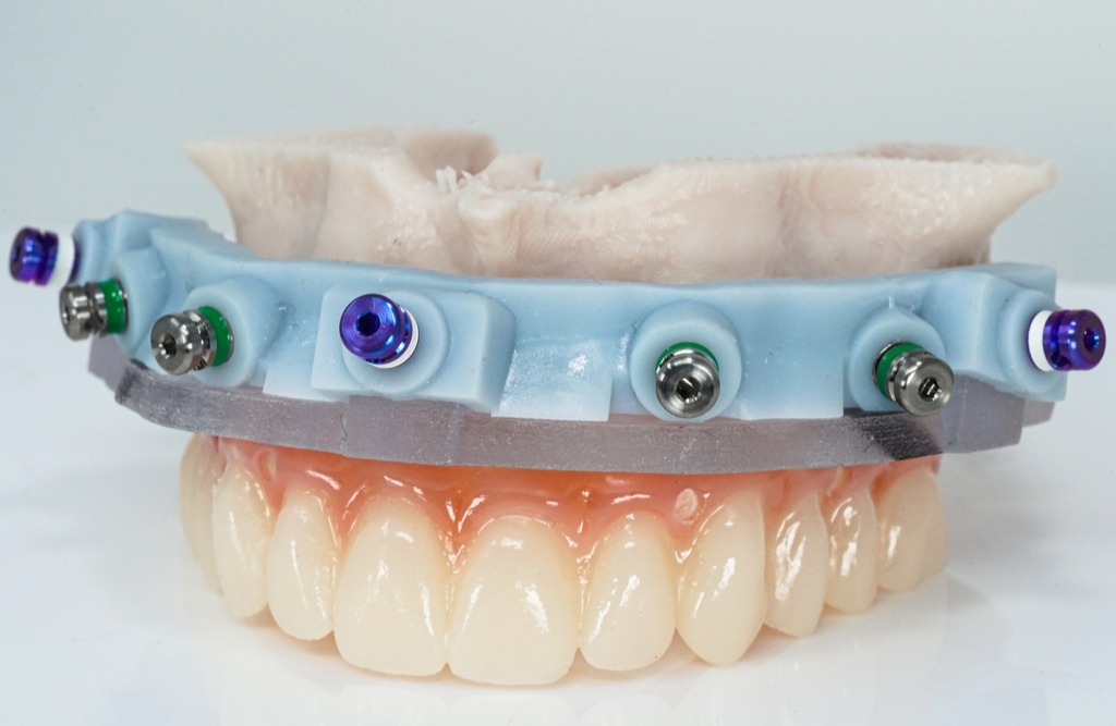 GuidedSMILE Lite (3)-1-1