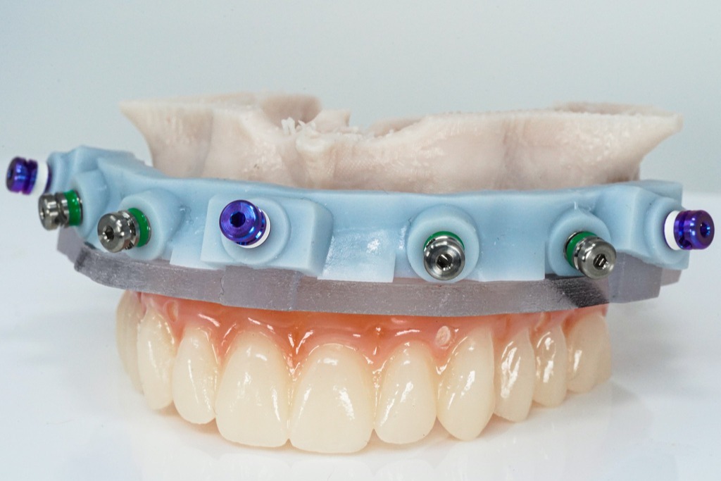 GuidedSMILE Lite (3)-1