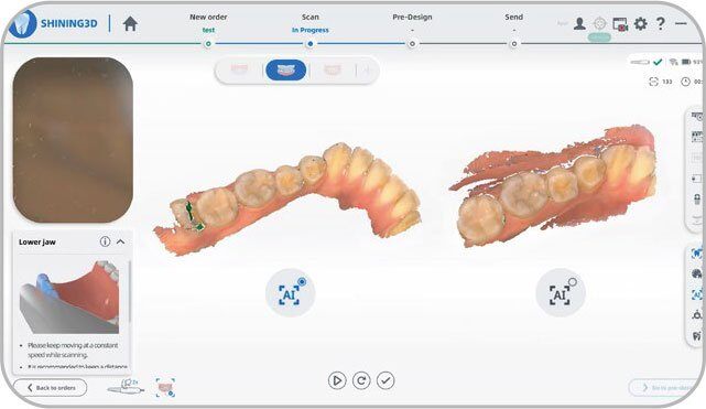Aoralscan-Elite-AI-Scanning
