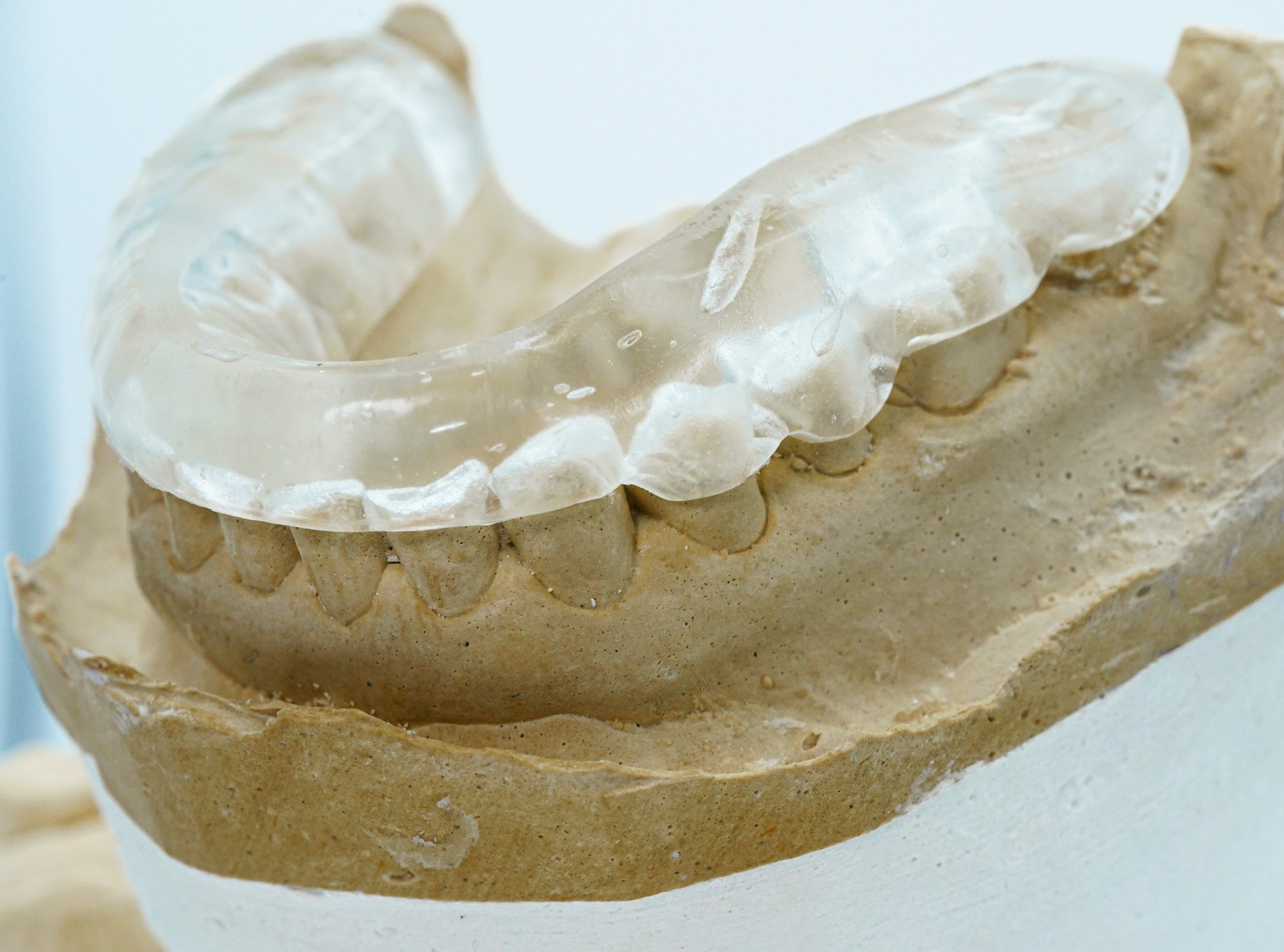 clearsplint-gal-3