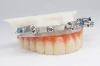 chrome-prosthetic1 chrome-prosthetic1