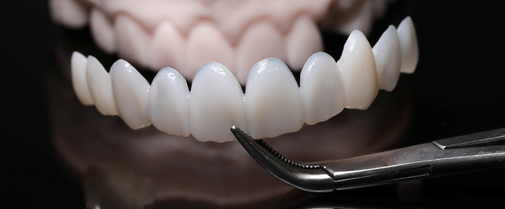 Trial Smile Frounfelter